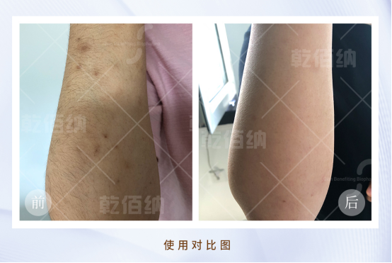 1688020638938214.png image.png